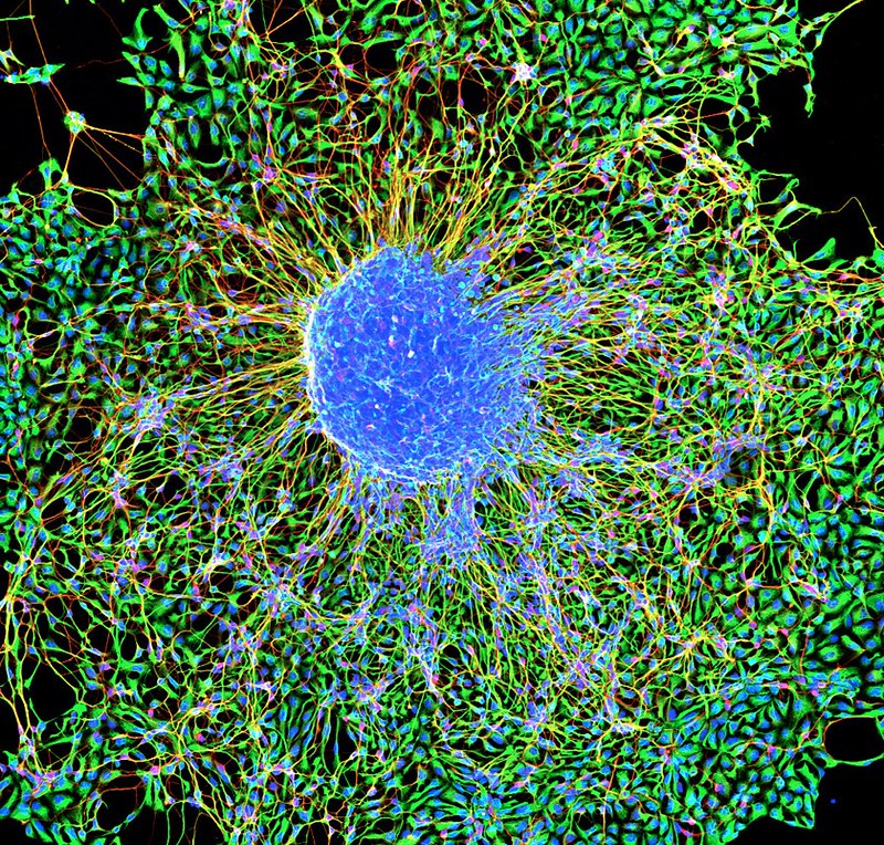 Green, blue, and yellow image of a stem cell