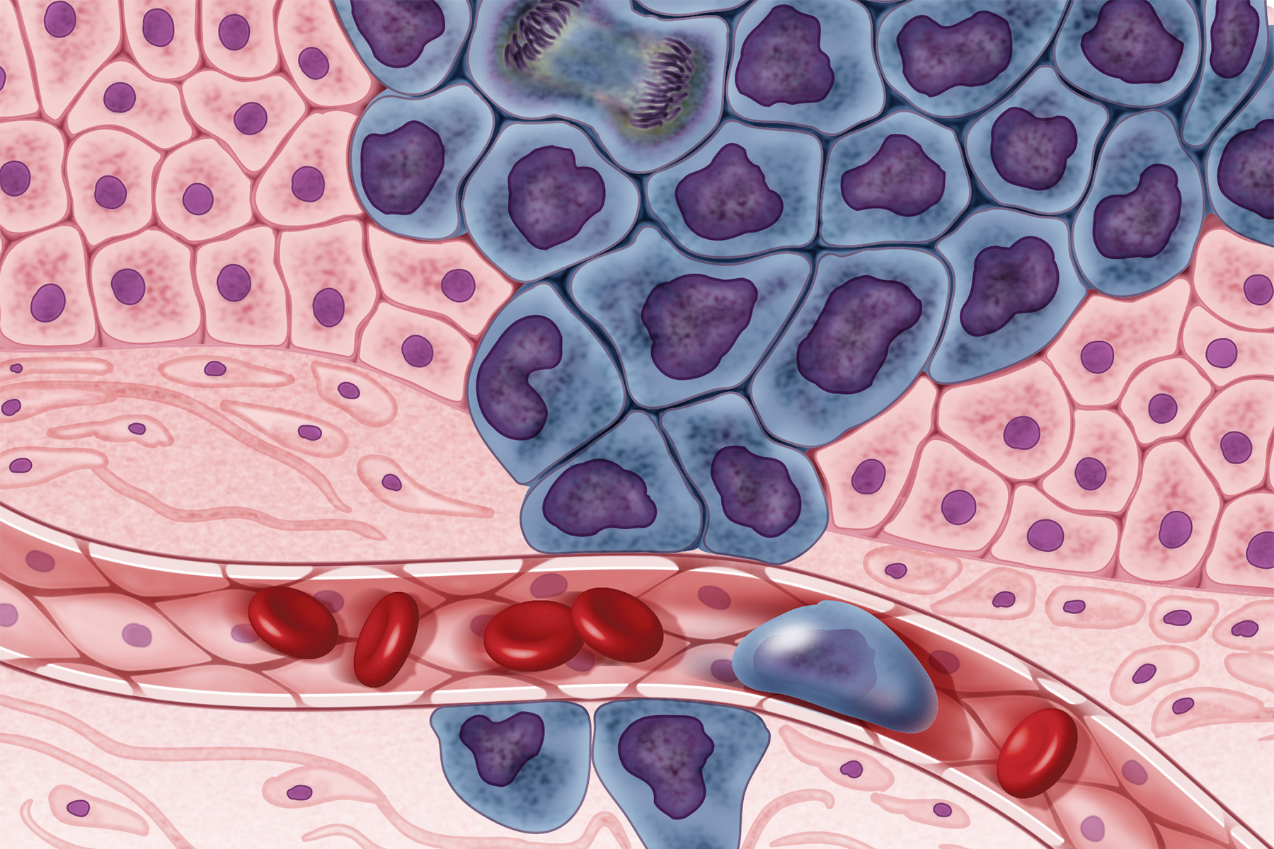 Pink, blue, and red depiction of cancer cells.