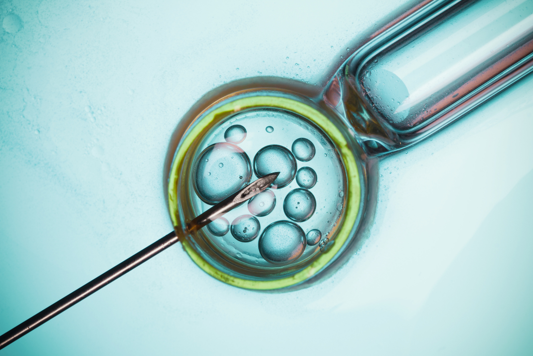ivf graphic