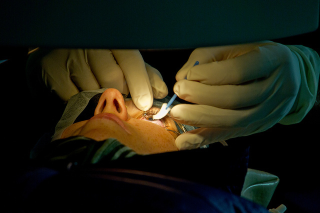 Patient lays horizontally. Image is a close up of a patient undergoing an eye procedure as a doctor touches the eye with an instrument.