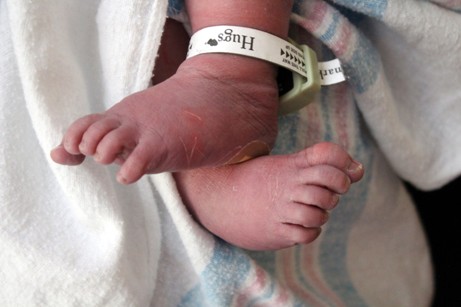 A newborn baby's feet are shown, with a hospital tag on the left foot.