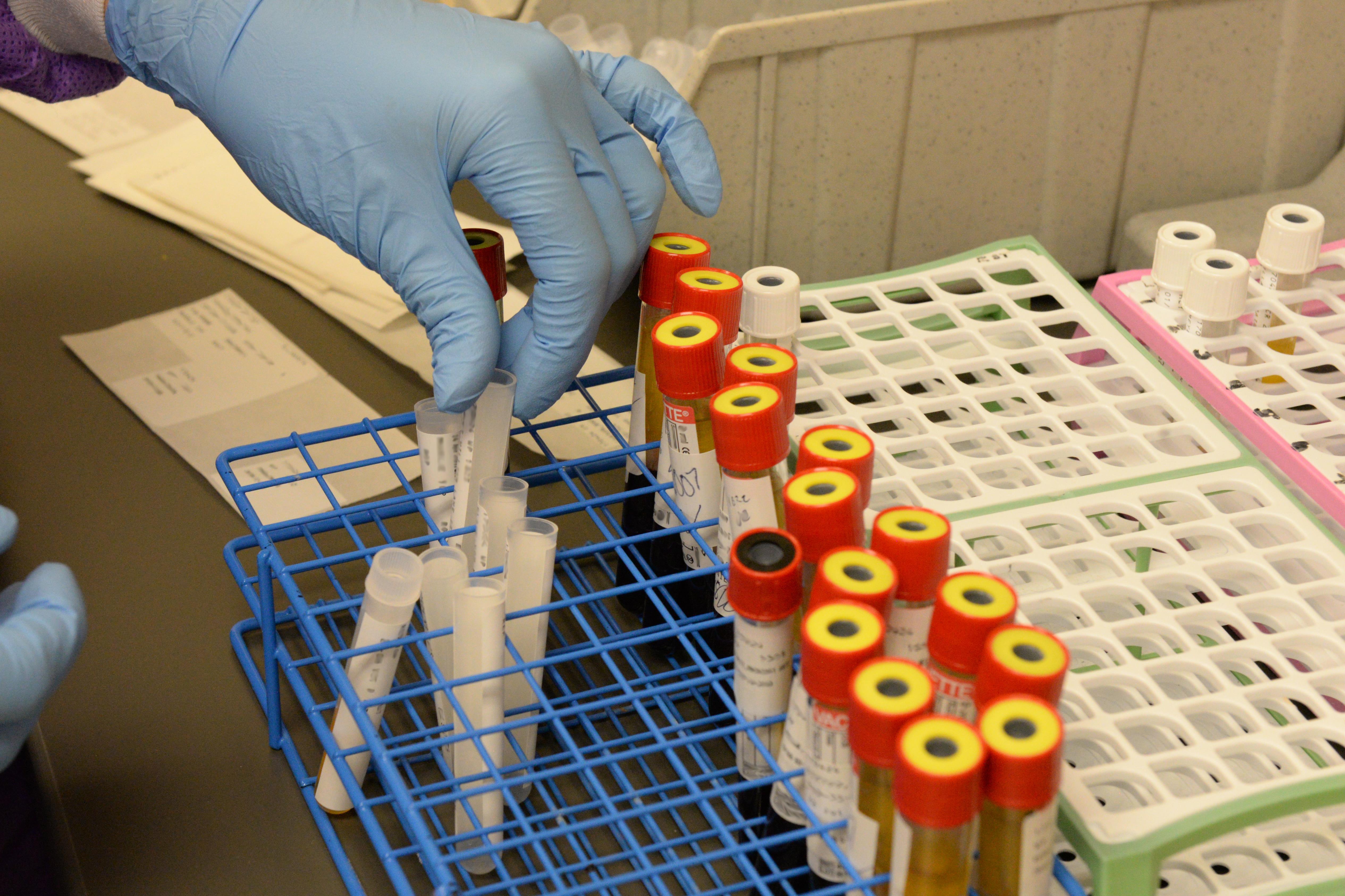 A test tube rack is filled with test tubes. A gloved hand lifts one of the open test tubes, positioned to read the label.