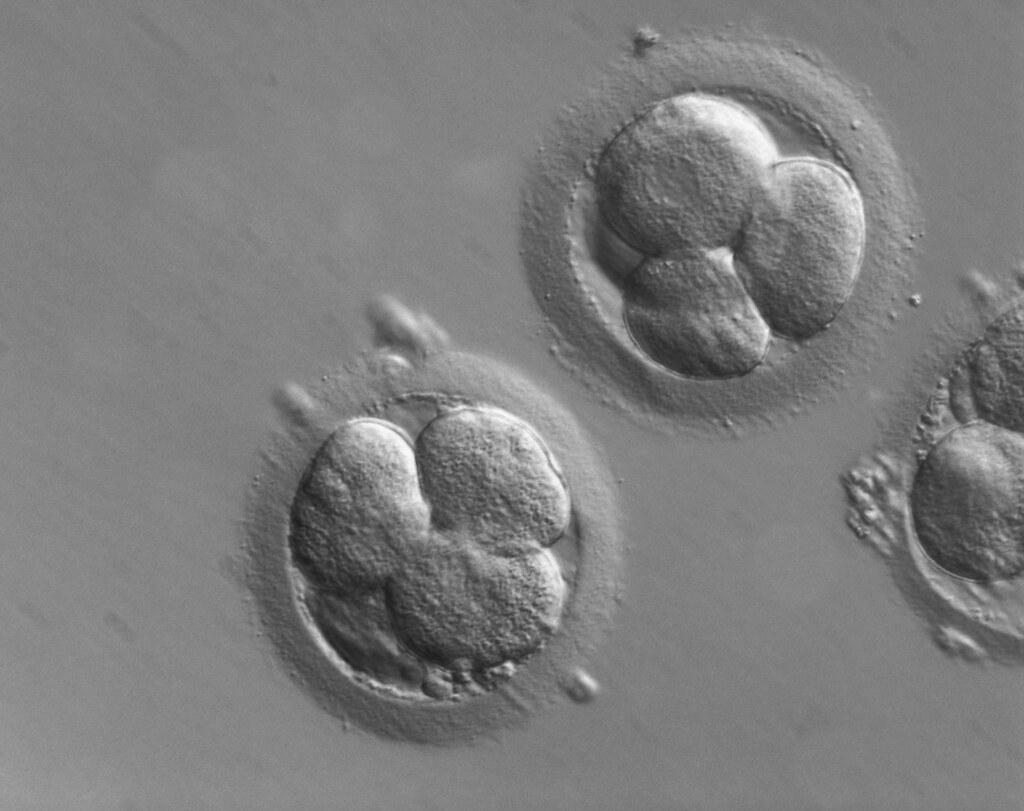 3 early human embryos in grayscale