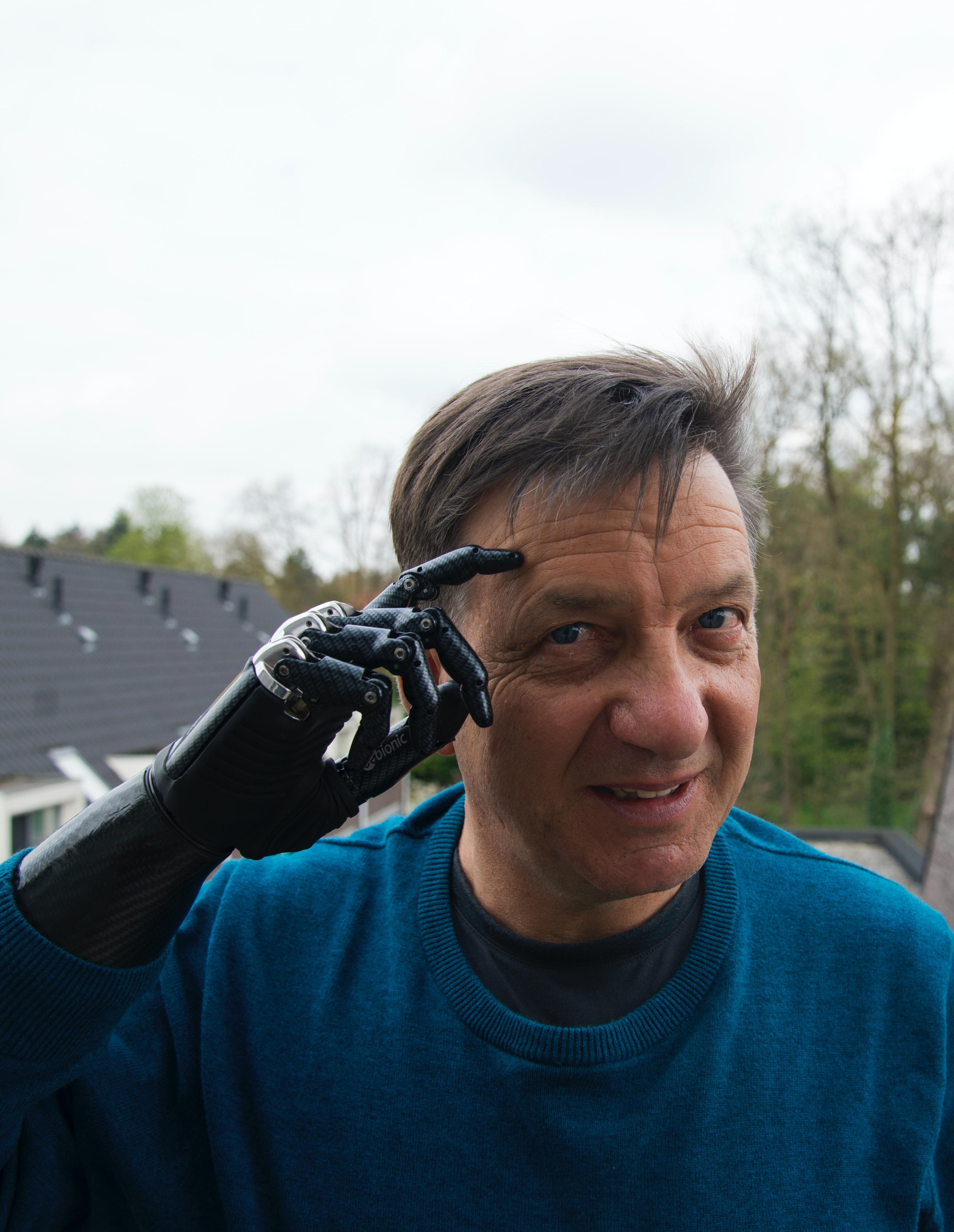 man with bionic arm