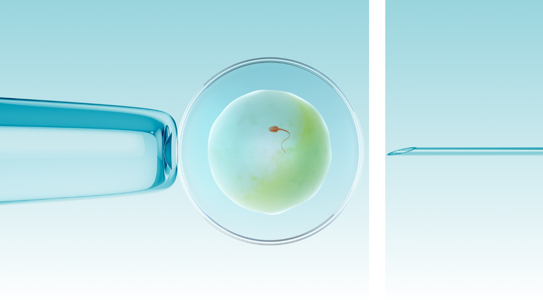 IVF graphic interrupted partway