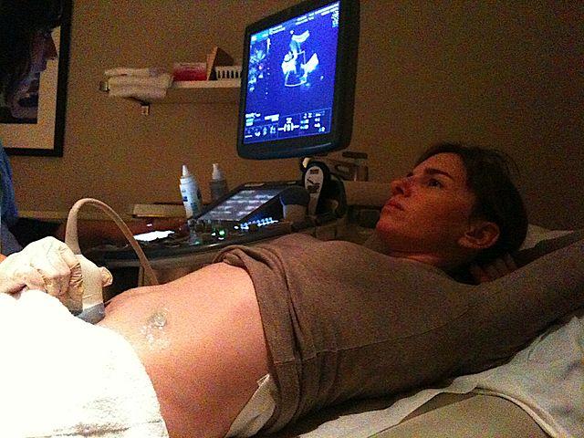 Woman receiving an ultrasound exam