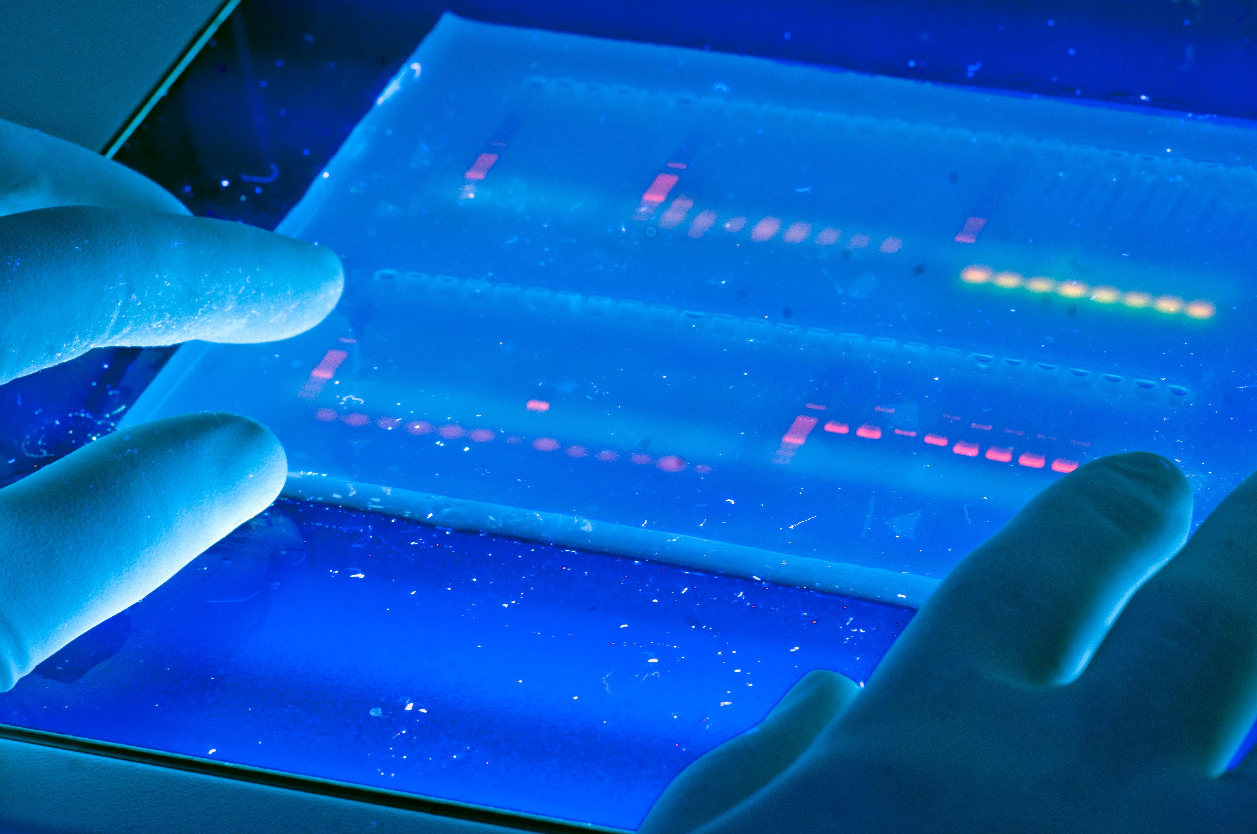 DNA profile illuminated by a light.