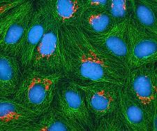 Microscope images of HeLa cells colored in green and blue