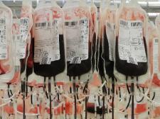 Several blood bags are filled.