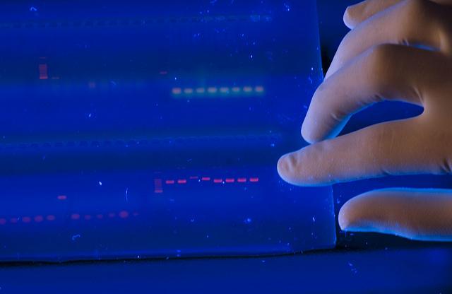 A gloved hand examines a blue tray of red and green DNA test results.