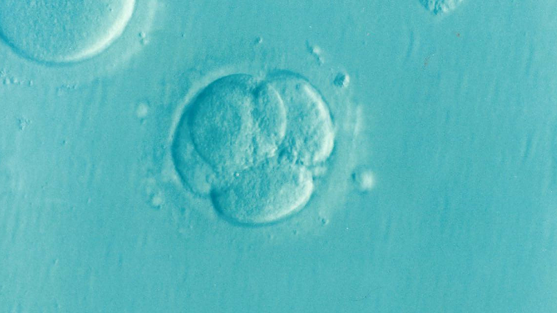 An embryo.