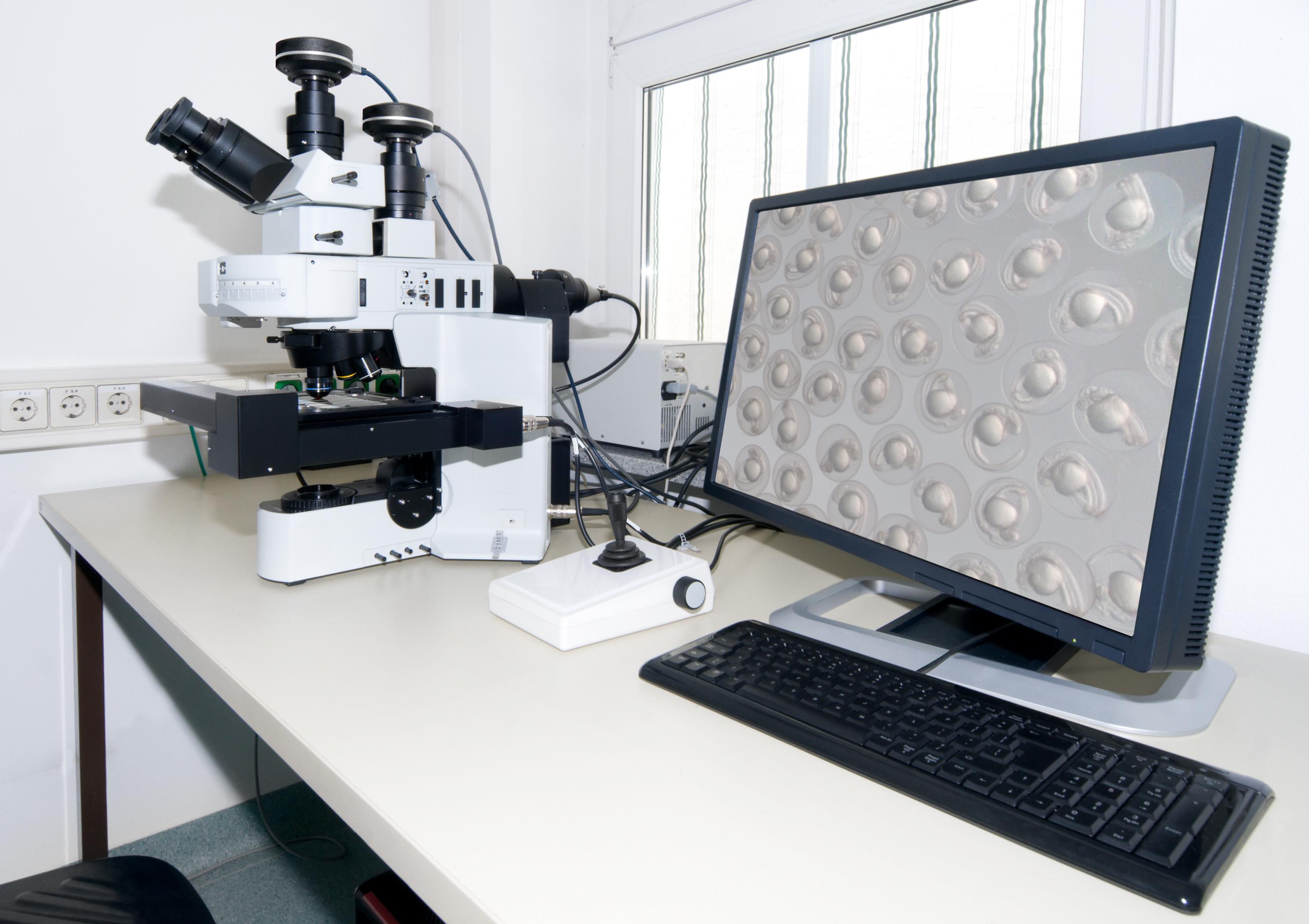 a microscope and screen on a table with the screen displaying a microscopic image of some embryos