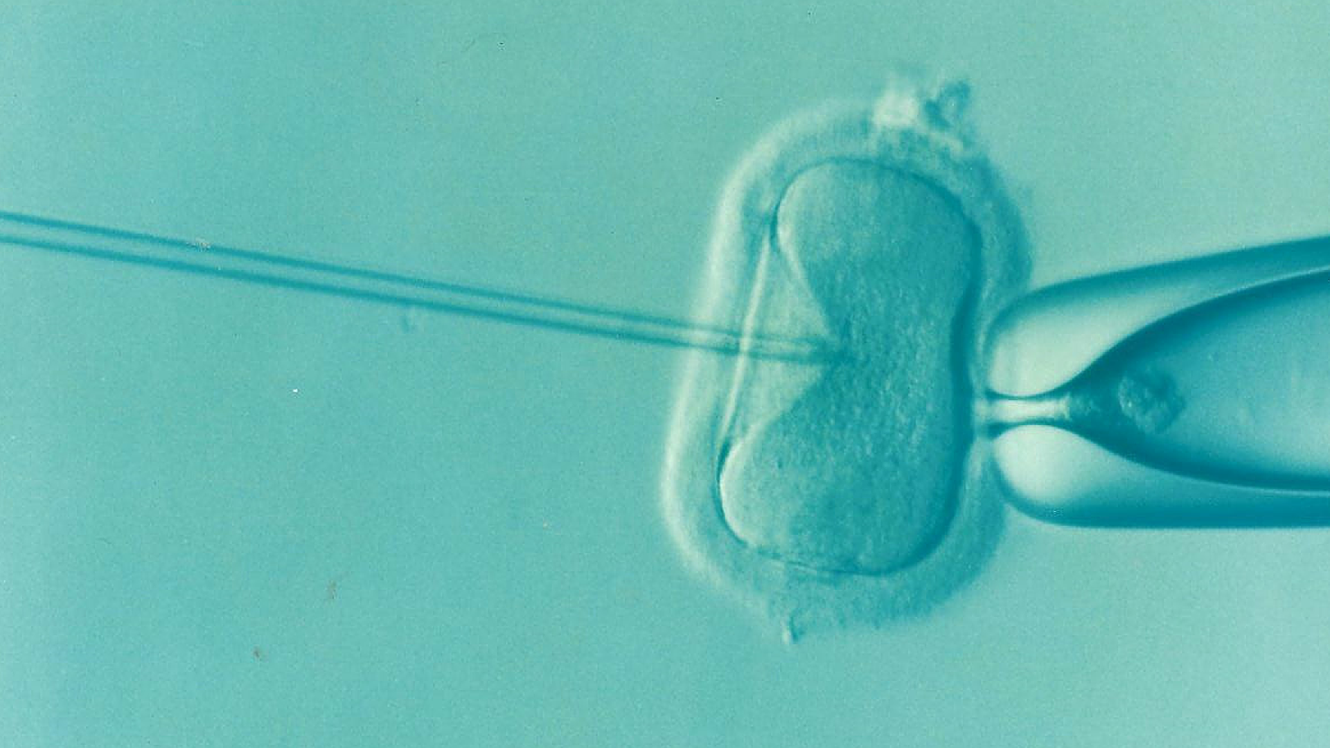 Microscopic image of an egg being fertilized by intracytoplasmic sperm injection