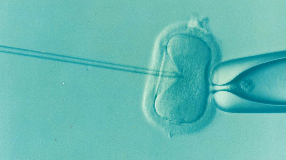 A teal colored photo of IVF taking place