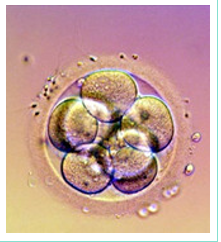 IVF photo