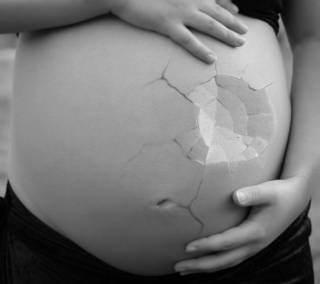 Gray scale photo of a pregnant stomach. Two hands hold the belly along the top and bottom. The belly appears cracked.