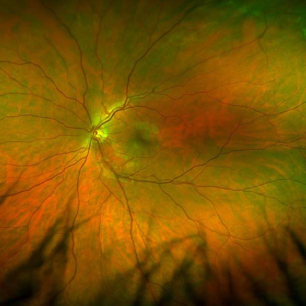Close-up of an eye retina.